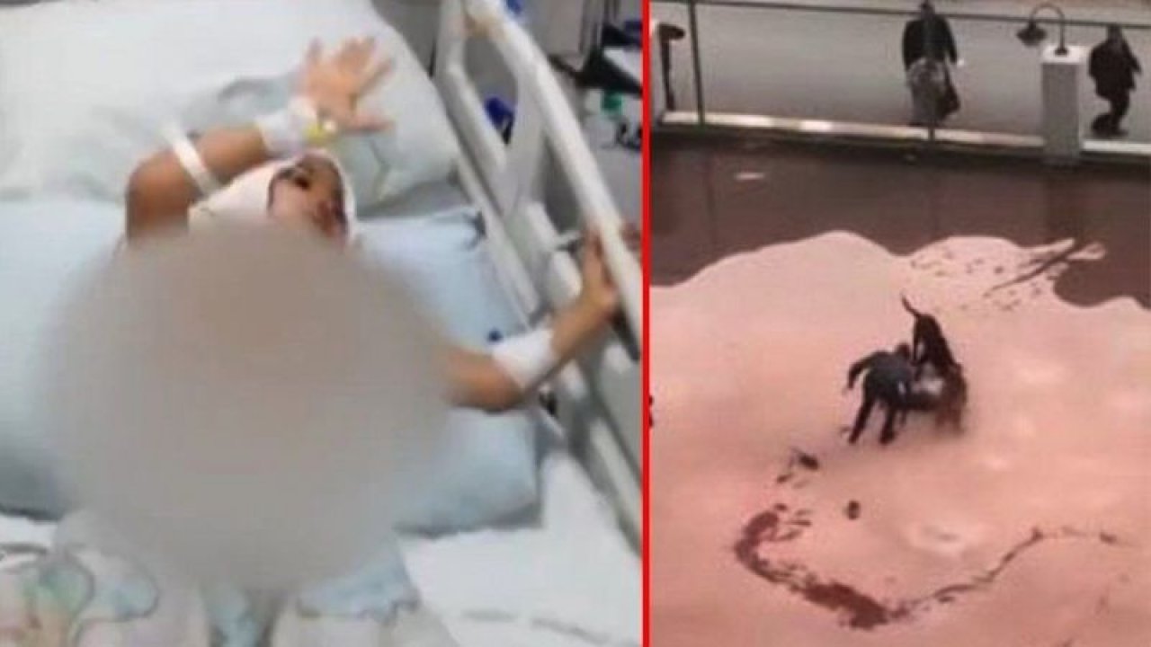 Pitbull saldırına uğrayan Asiye Ateş’in son durumu belli oldu! Antalya’ya sevk edildi