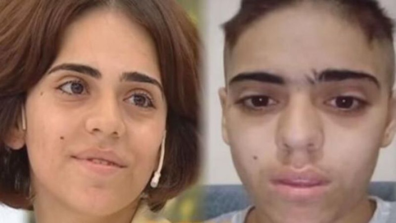 Esra Erol’a konu olan Fatma’nın son hali görenleri üzdü…