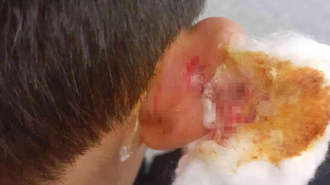 Öğrencisinin kulağını çekerek yaralayan öğretmene hapis istemi