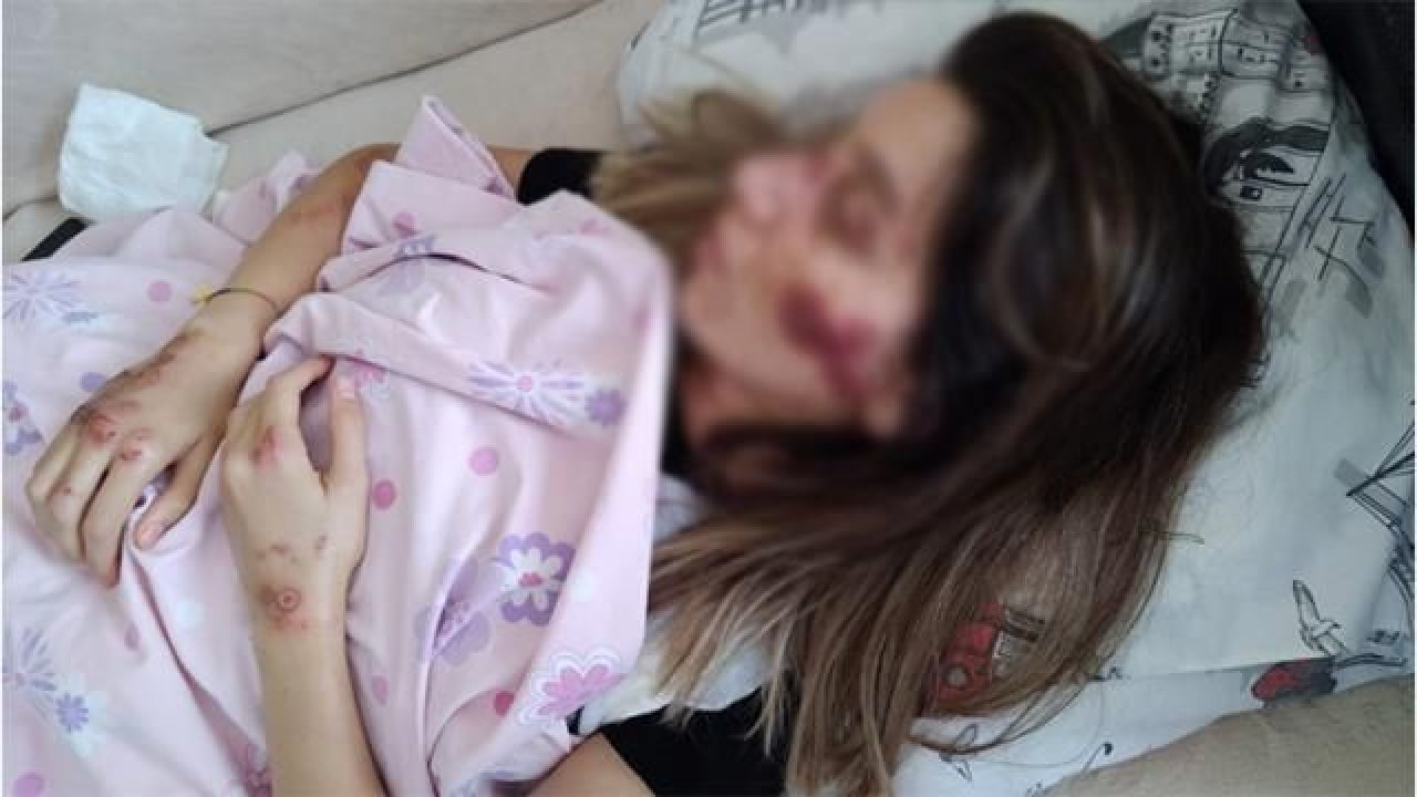 Skuter faciası bitmiyor! Hemşire Hatice Şener dehşeti yaşadı