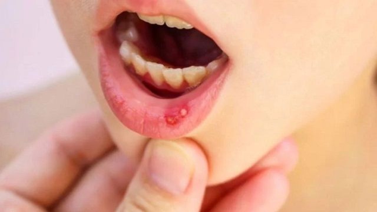 Uzmanlardan açıklama geldi: Covid-19’un yeni belirtisi ortaya çıktı!