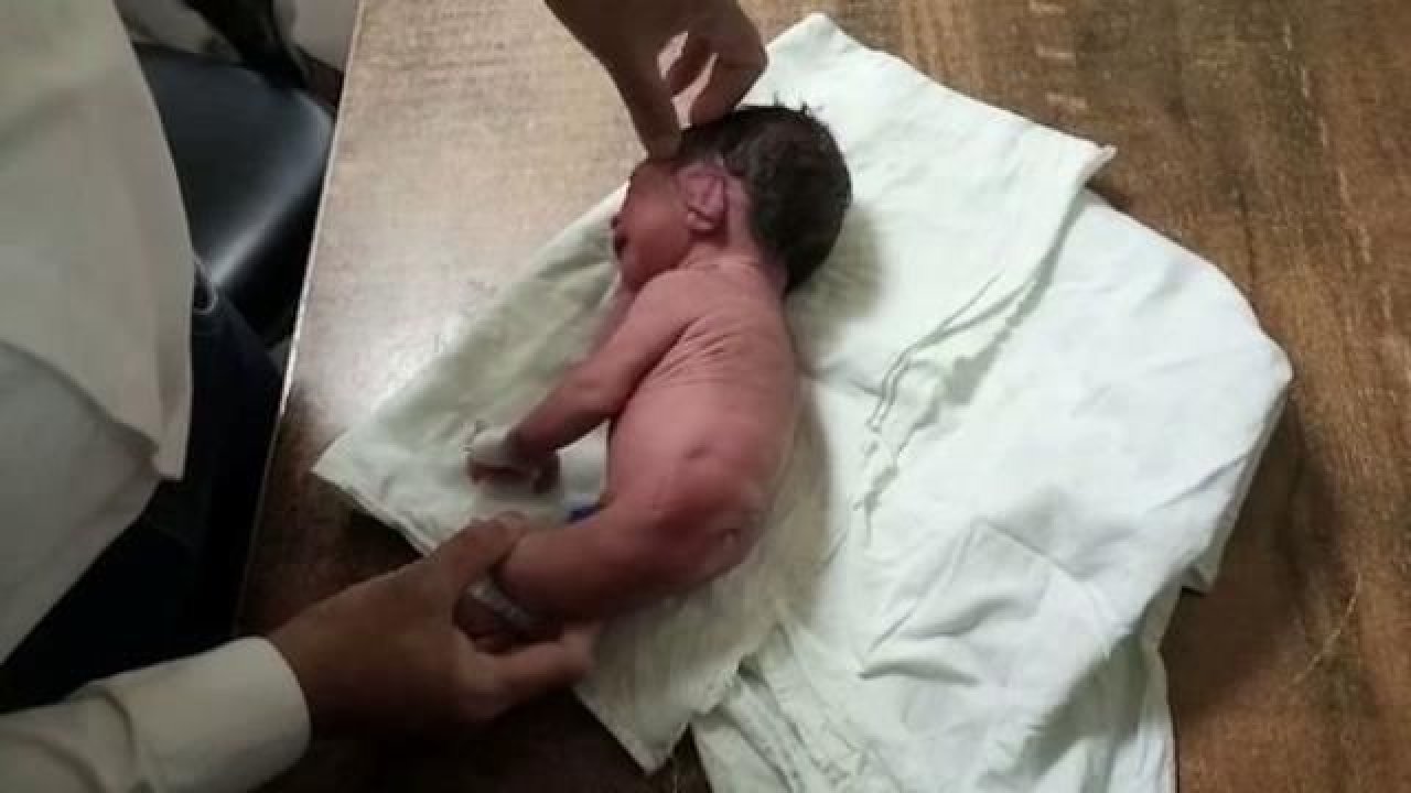 Hindistan’da doğan bebek doktorların ağzını açık bıraktı! Ayakları yerine boynuz…