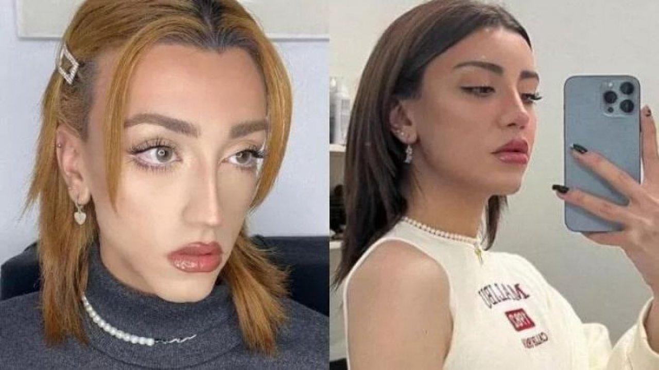 Cinsiyet değiştirmişti! Mika Raun yaptırdığı ameliyatlara ne kadar ödediğini açıkladı!