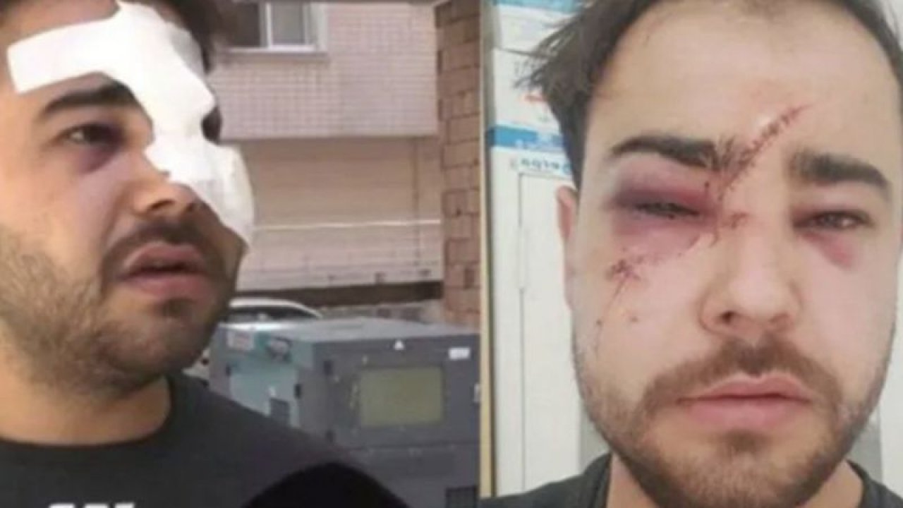Bir Onur Şener vakası daha! İstek parçayı bilmediği için yüzünde şişe kırdılar!