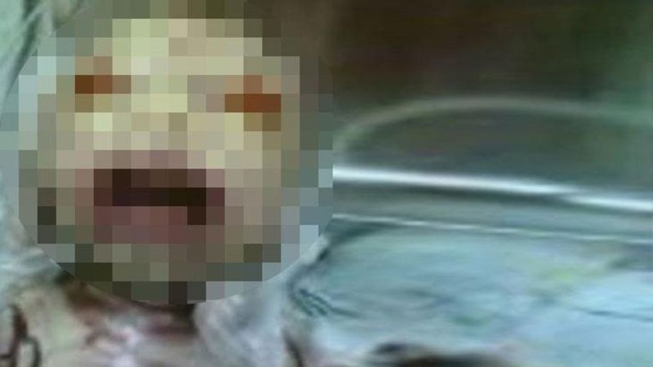 Aydın’da dünyaya gözünü açan “yılan bebek” günlerce konuşulmuştu! Son hali ortaya çıktı