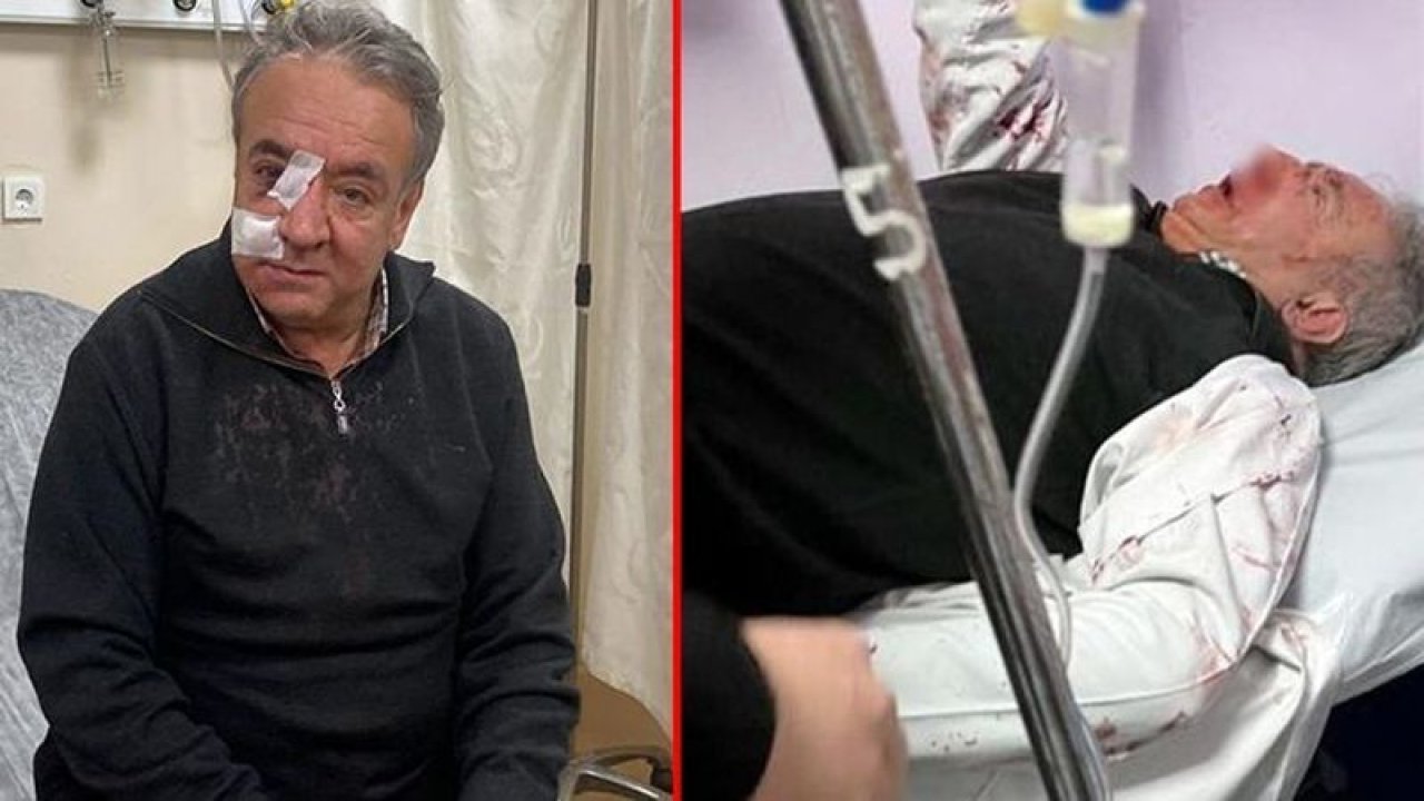 Bağcılar’da sağlık ocağında kendisini uyaran doktoru öldüresiye kadar dövdü!  Doktor o anları anlattı! “Ölmediğime şükrediyorum”