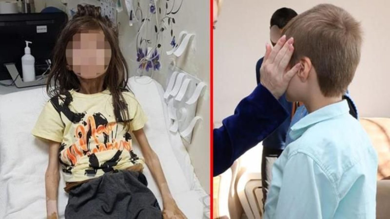 Teyzesi 1 yıl boyunca odaya kitlemişti! Çöp evde bulunan Cem Muhammet’in son hali yüzleri güldürdü!